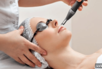 Revolutionizing Acne Treatment with Lasers